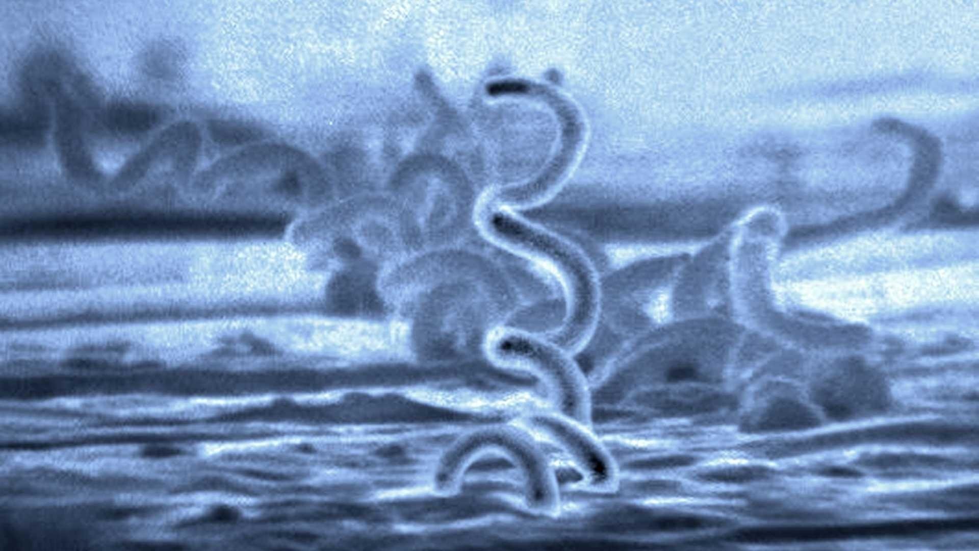 Under Our Skin Background