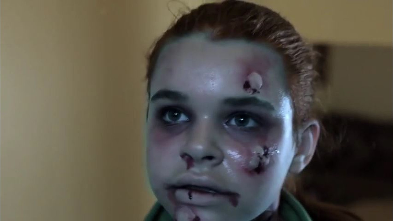 E19 Virus Background